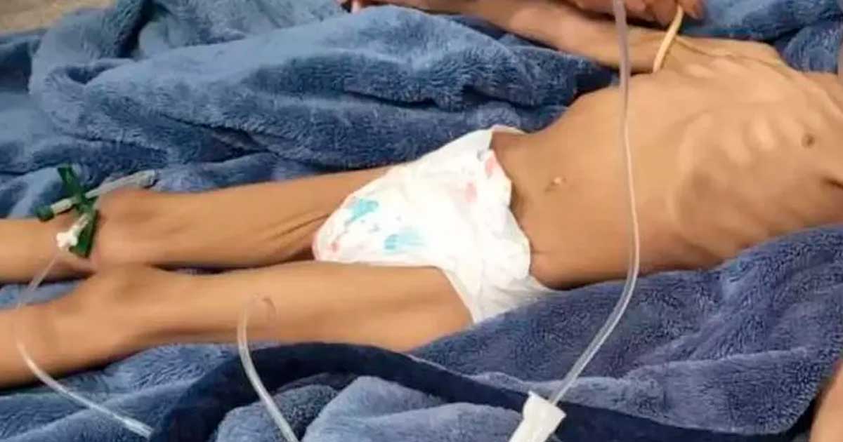 Criança de 3 anos é resgatada desnutrida em Rio Claro — Foto: Arquivo Pessoal